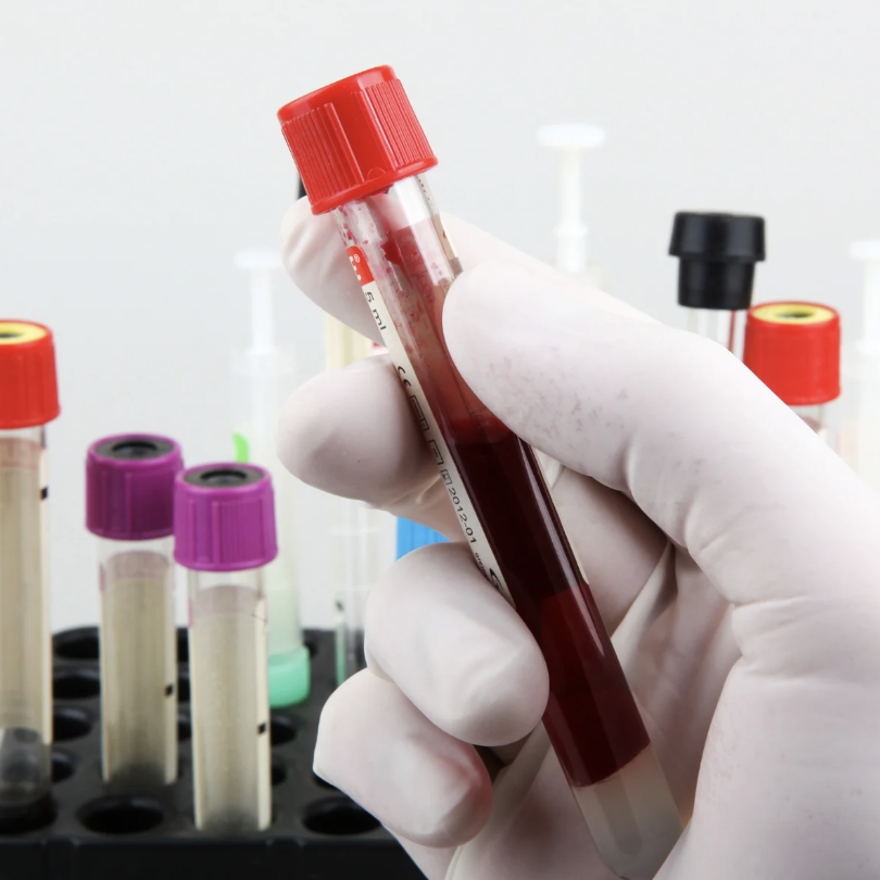 ON-SITE LAB SERVICES